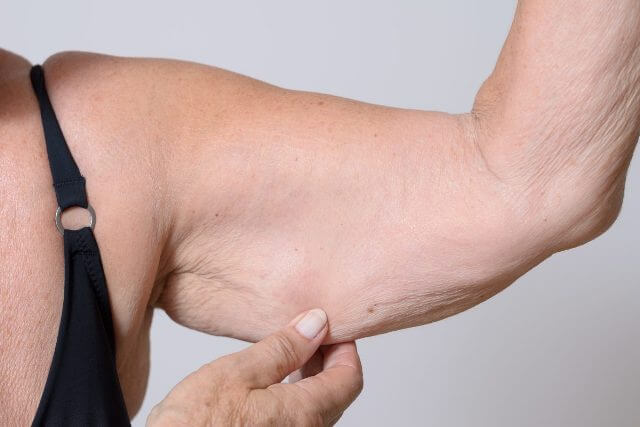 loss-of-muscle-mass