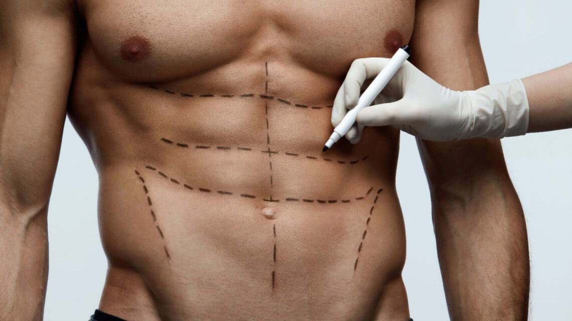 male-plastic-surgery-procedures-for-men