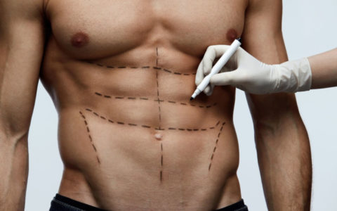 male-plastic-surgery-procedures-for-men