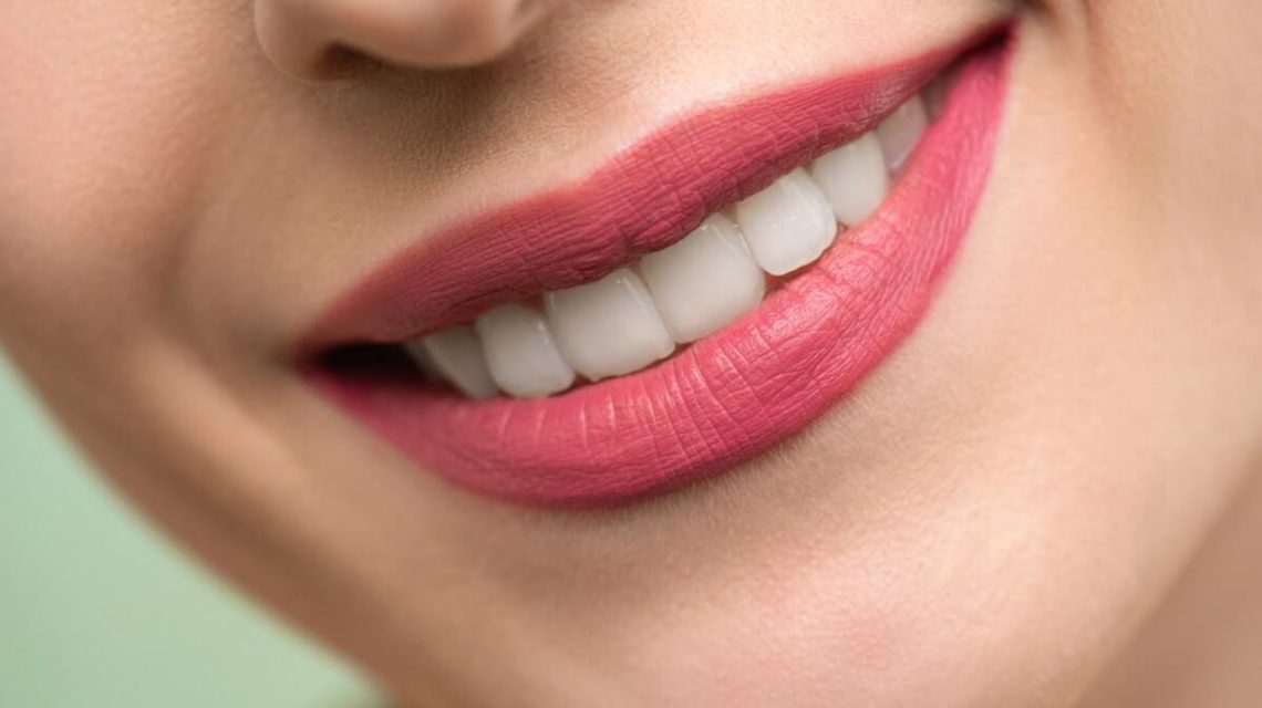 composite bonding teeth