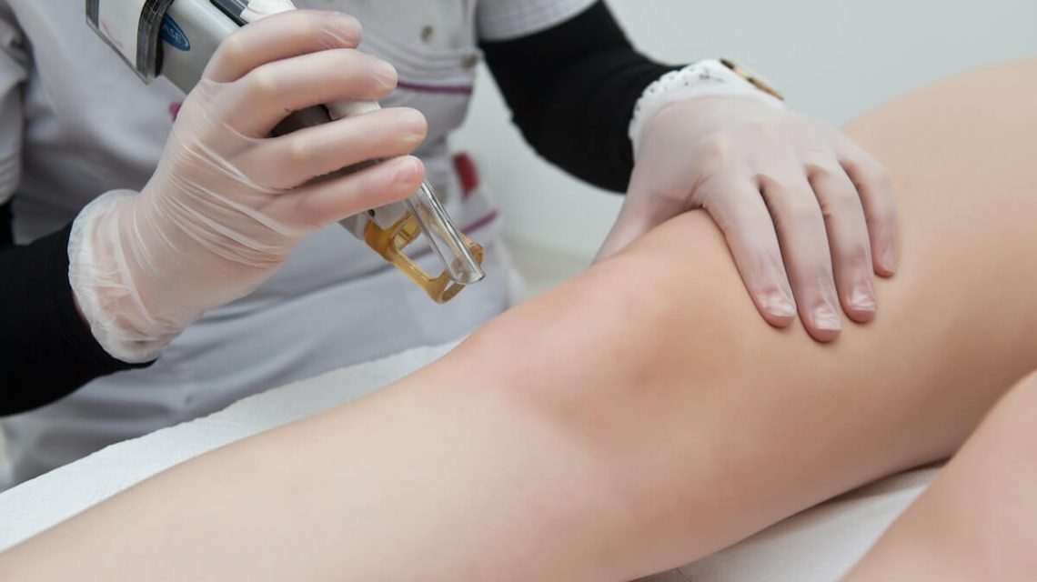 Top 5 Mistakes After Knee Replacement